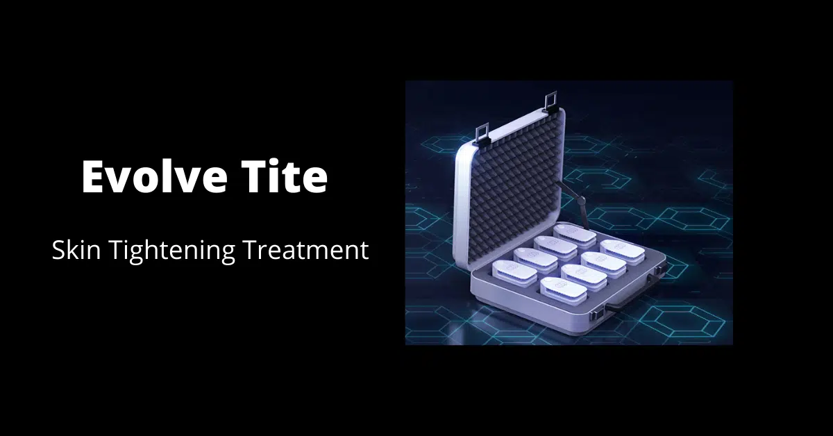 skin tightening in Orlando skin tightening in Orlando