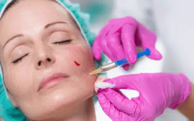 Face Fillers – Here’s What You Should Know