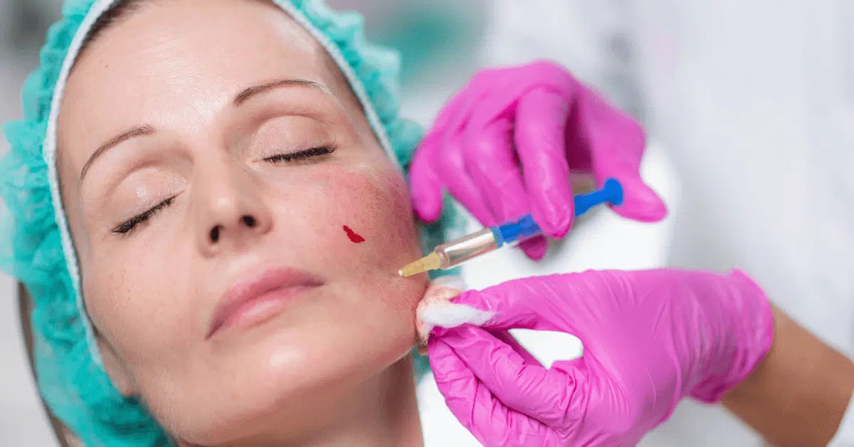face fillers near Orlando