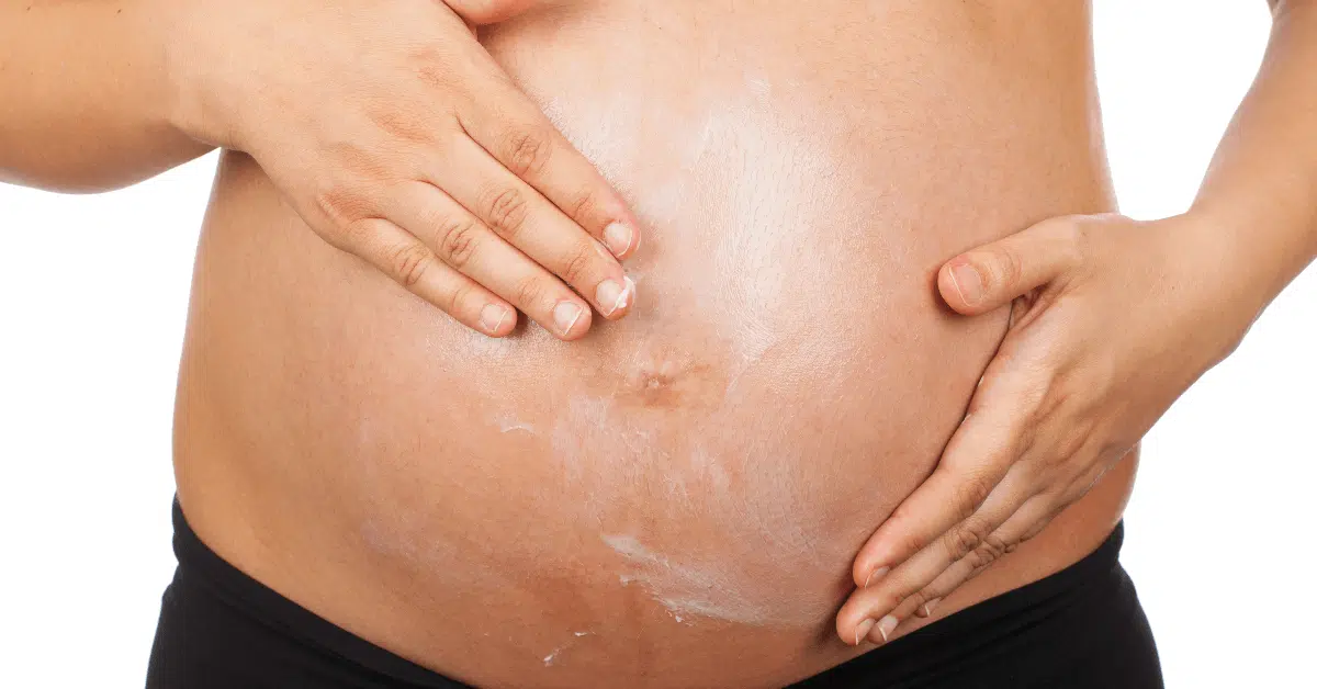 stretch mark removal orlando and winter park