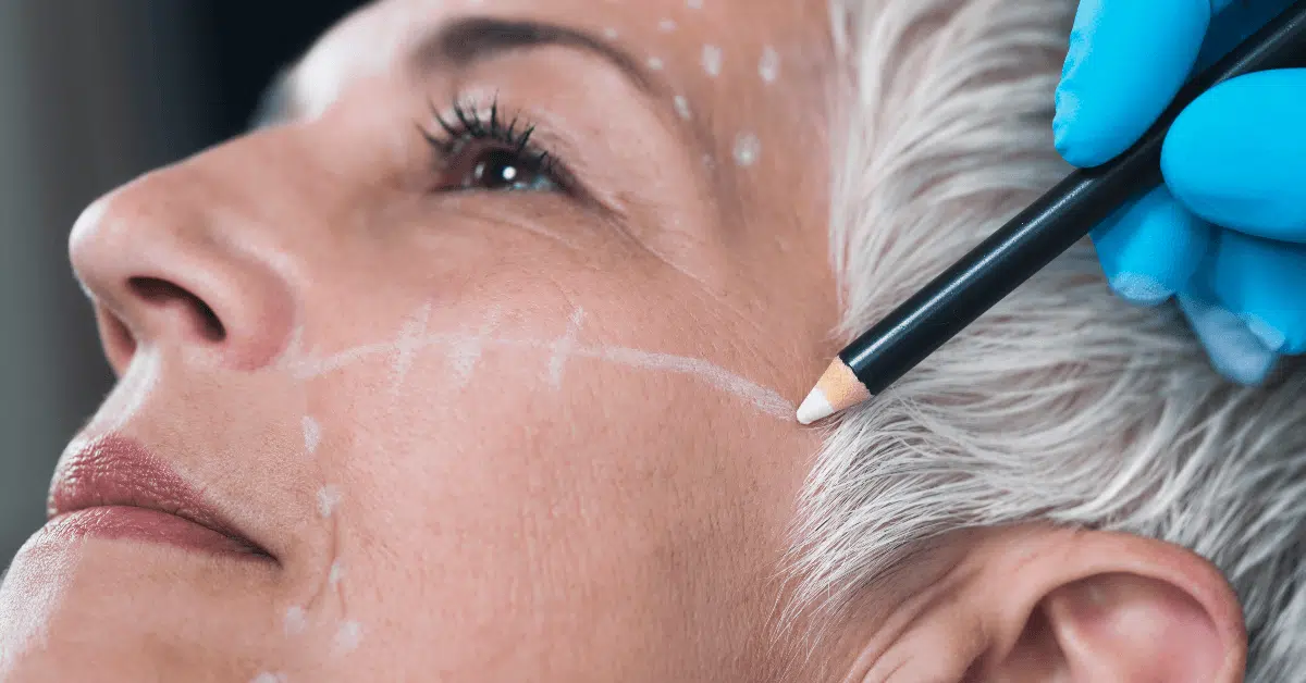 face slimming at Orlando Winter Park