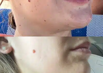 facial injections winter park med spa