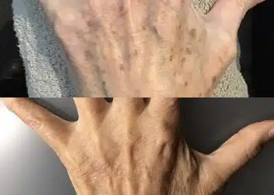 anti aging hands winter park