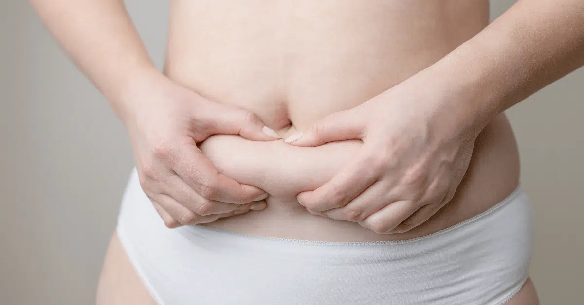 CoolSculpting