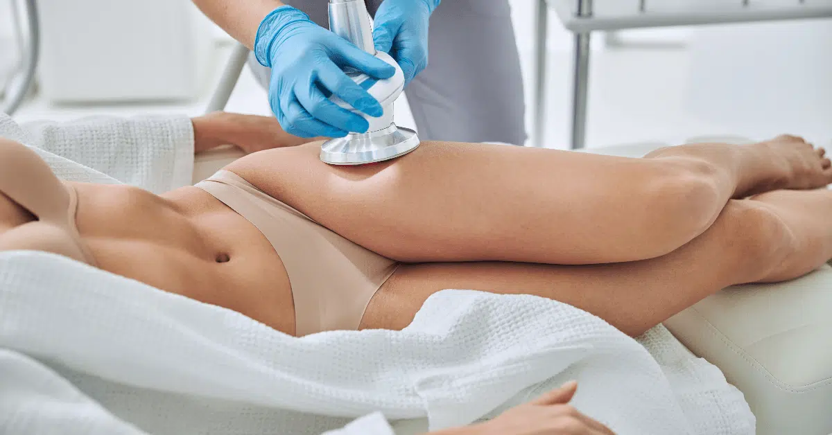 What Is Coolsculpting