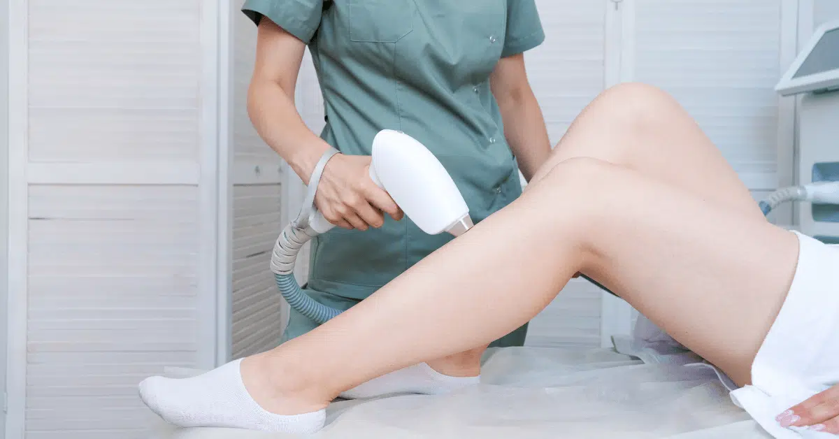 Laser Vein Removal