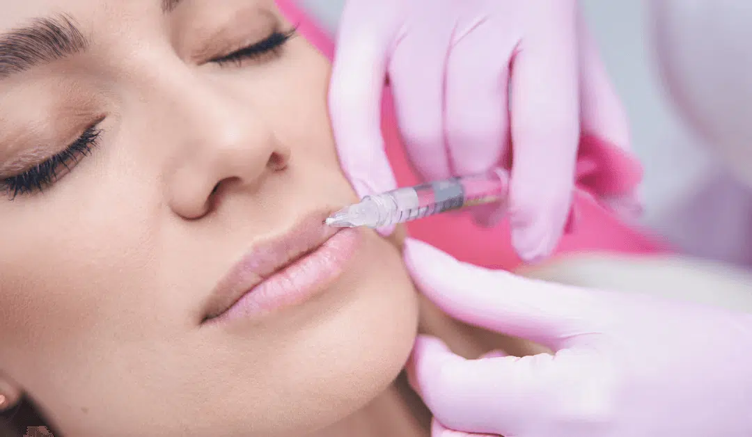 When is the Best Time to Get Lip Fillers?