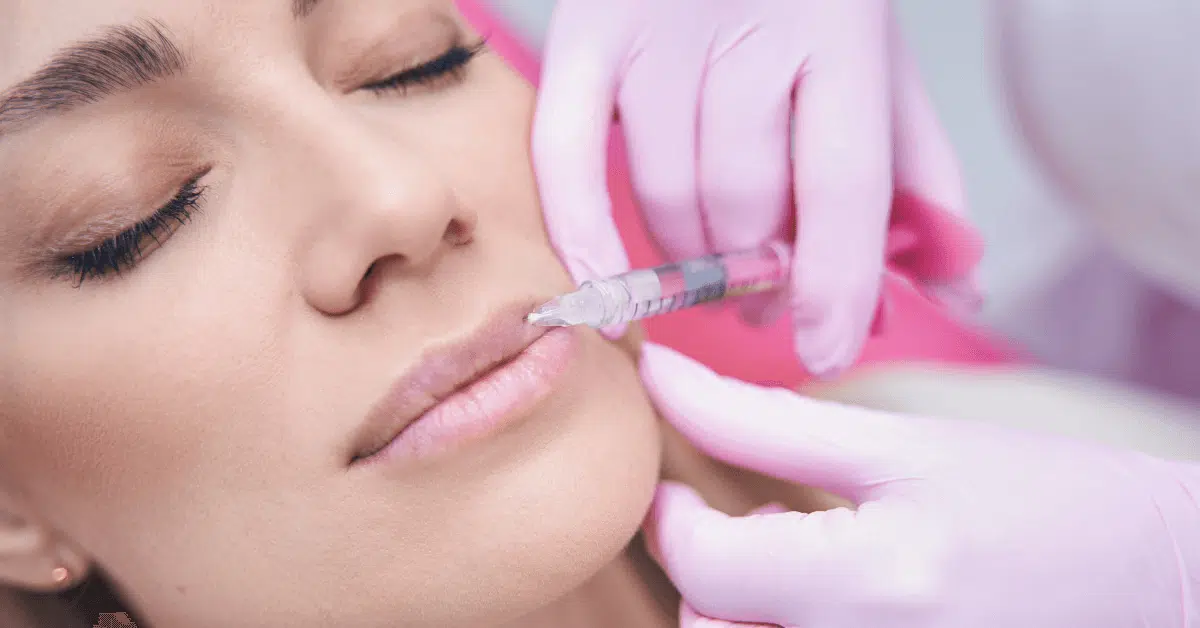 lip fillers jawline fillers in Orlando