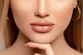 Lip Filler & Lip Fillers