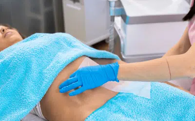 CoolSculpting in Orlando: Transform Your Body with Precision