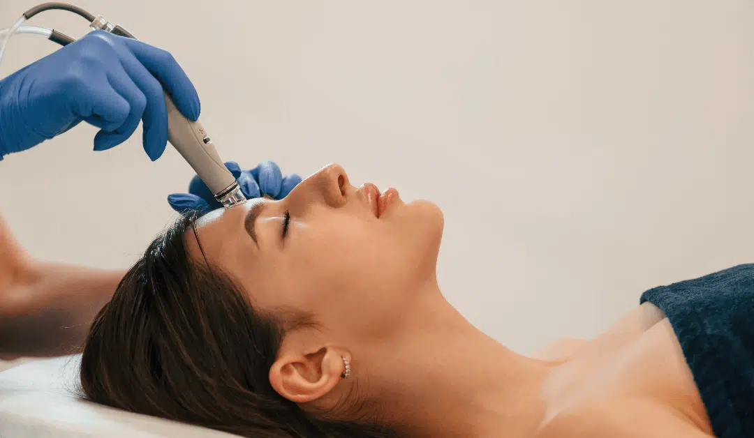 Elevate Your Skincare Routine: Exploring Microneedling