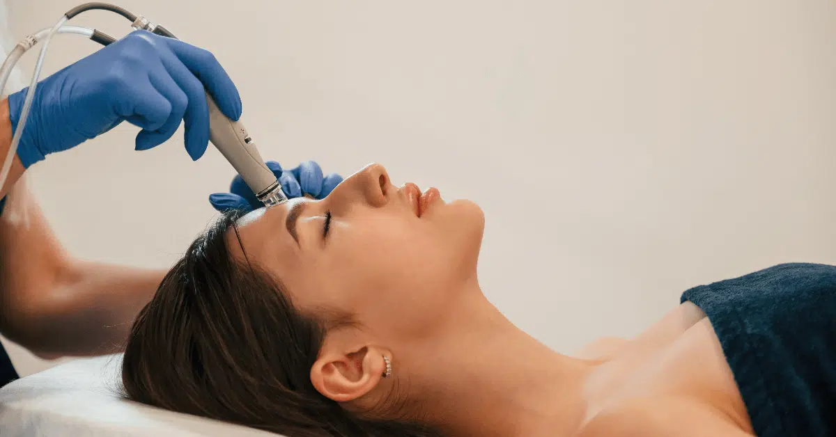 Microneedling
