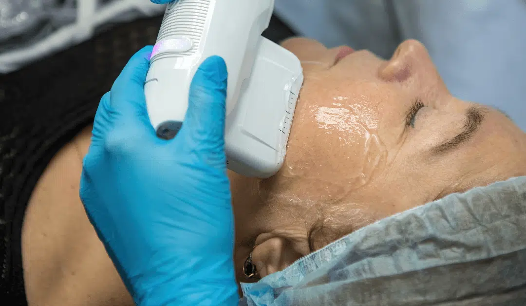 Rediscover Your Youth: Exploring the Benefits of Skin Tightening Treatment