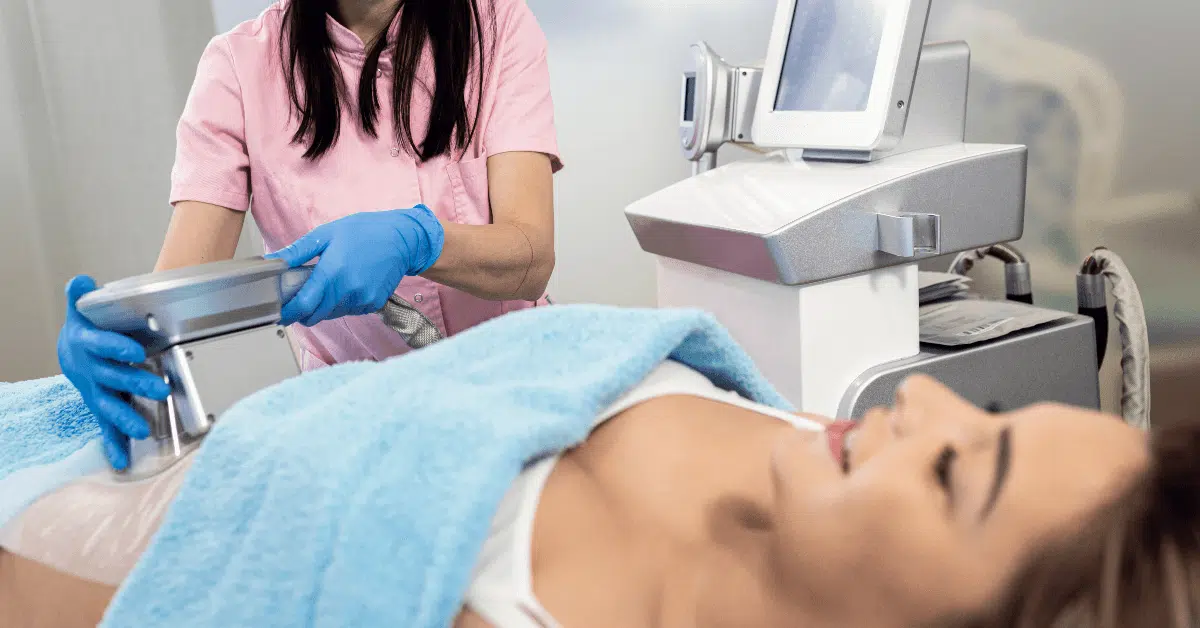 CoolSculpting result