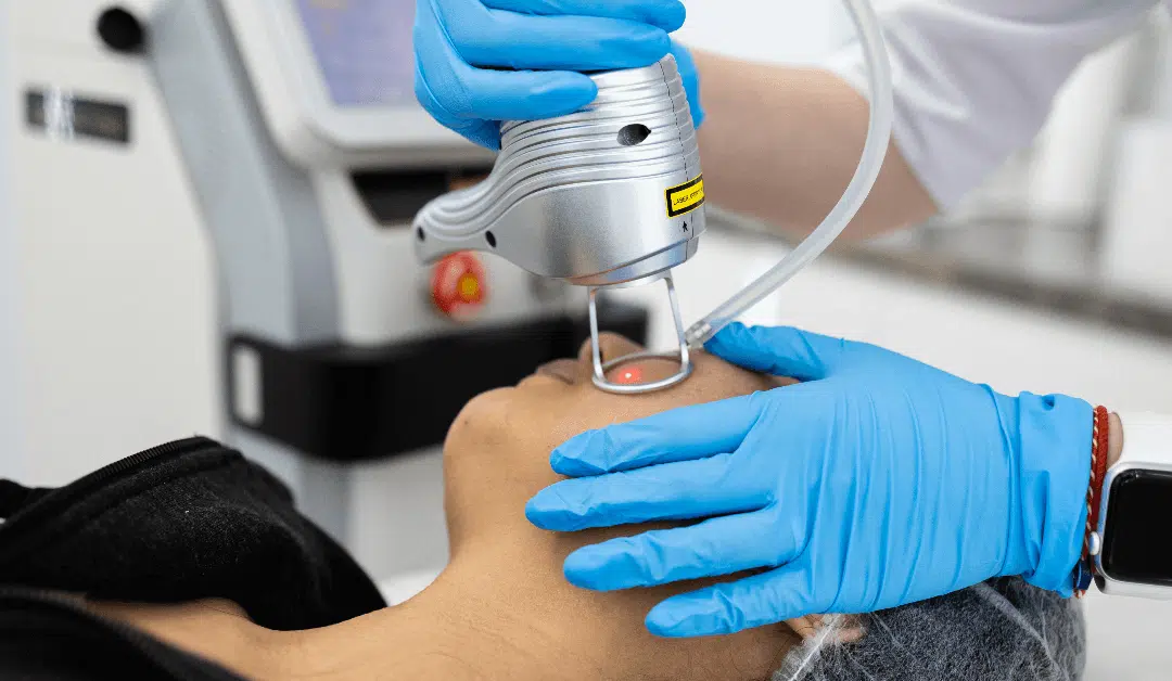 Pico Laser vs. Chemical Peels: Which is Right for Your Skin?