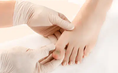 Understanding Toenail Fungus Onychomycosis: Causes, Symptoms, And Prevention