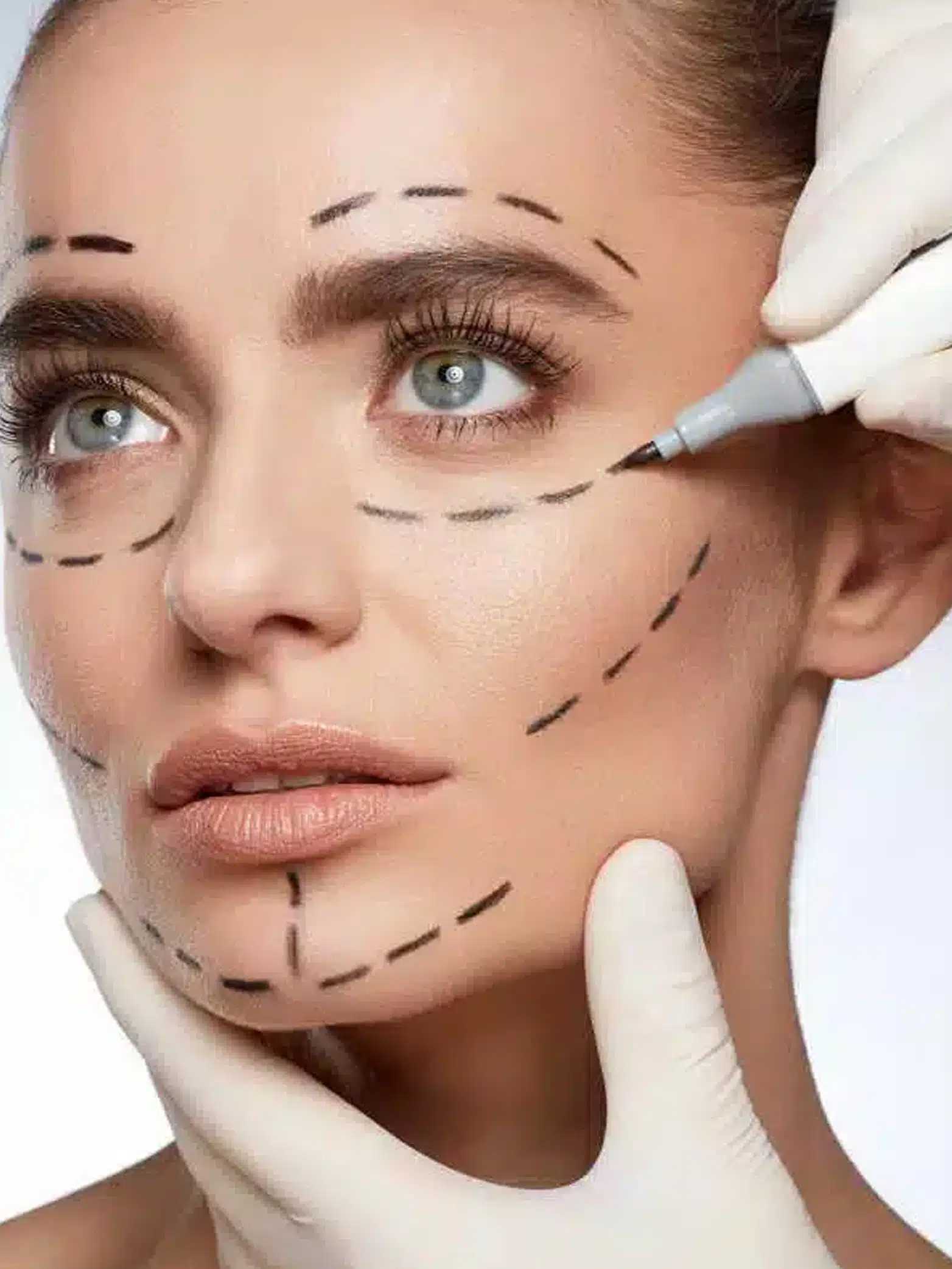 Facial Rejuvenation