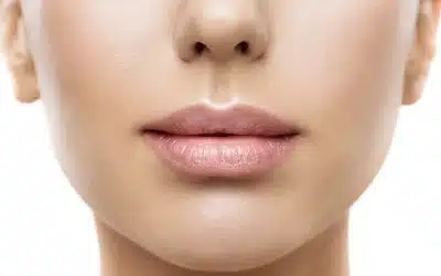 Botox For Mouth Corners