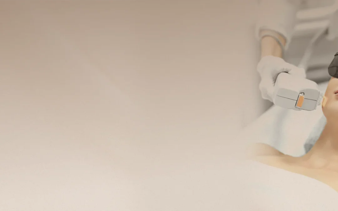 IPL Photofacial Olando