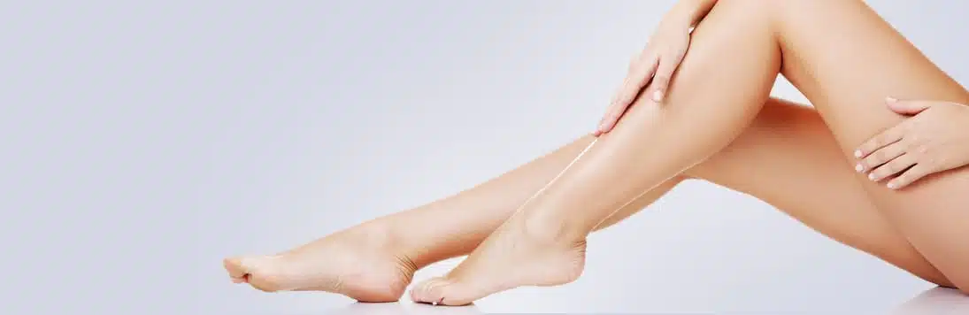 Laser Vein Removal Florida