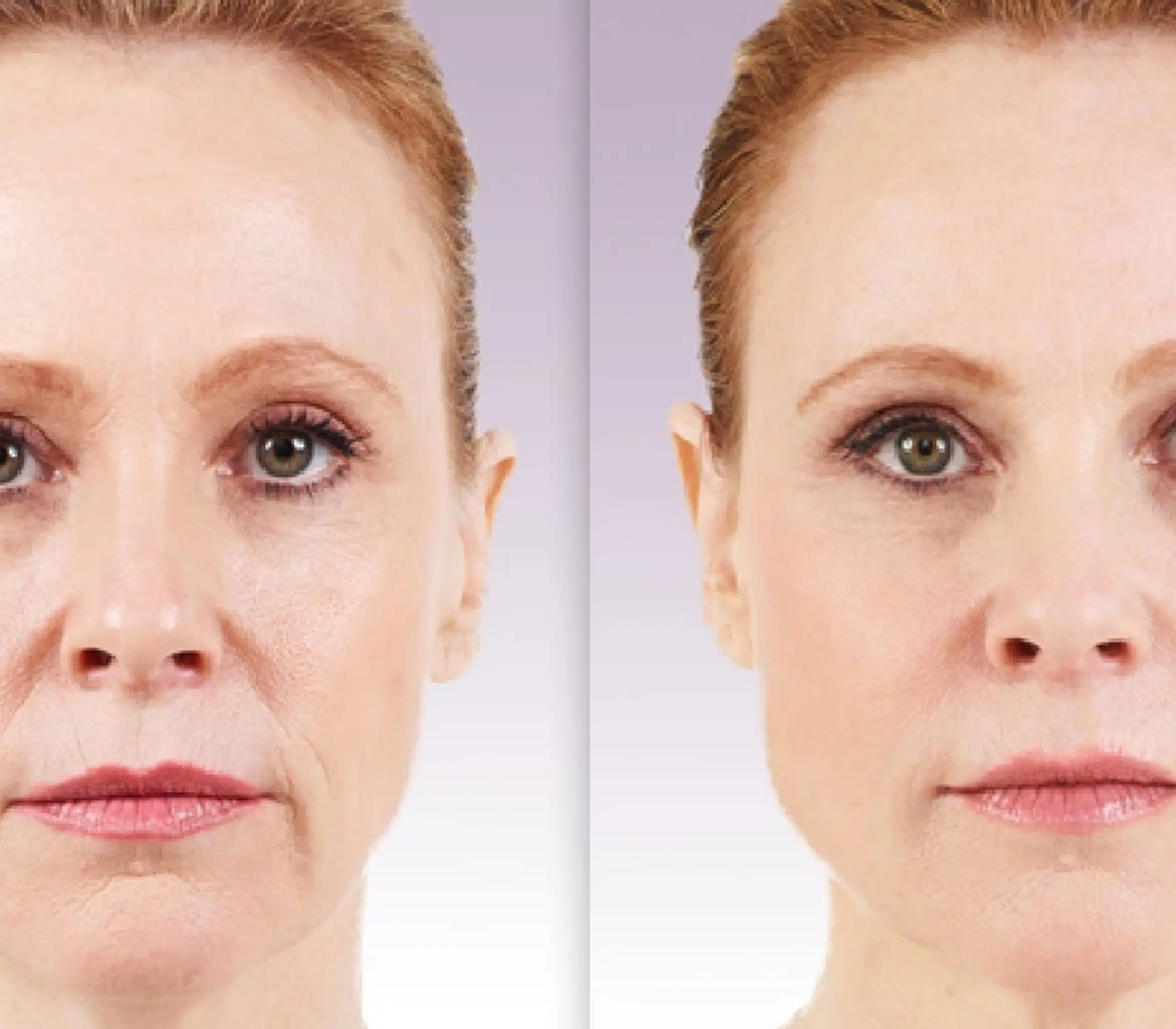 Enhance lips