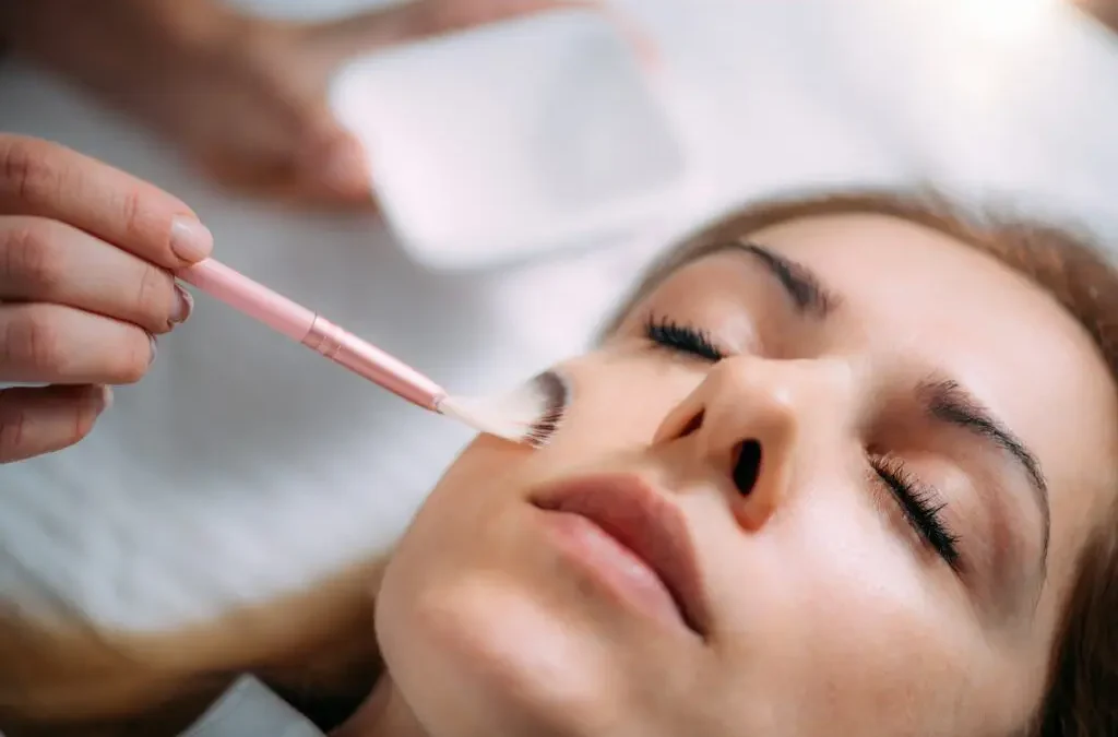 Chemical Peels Orlando – Restore Radiance