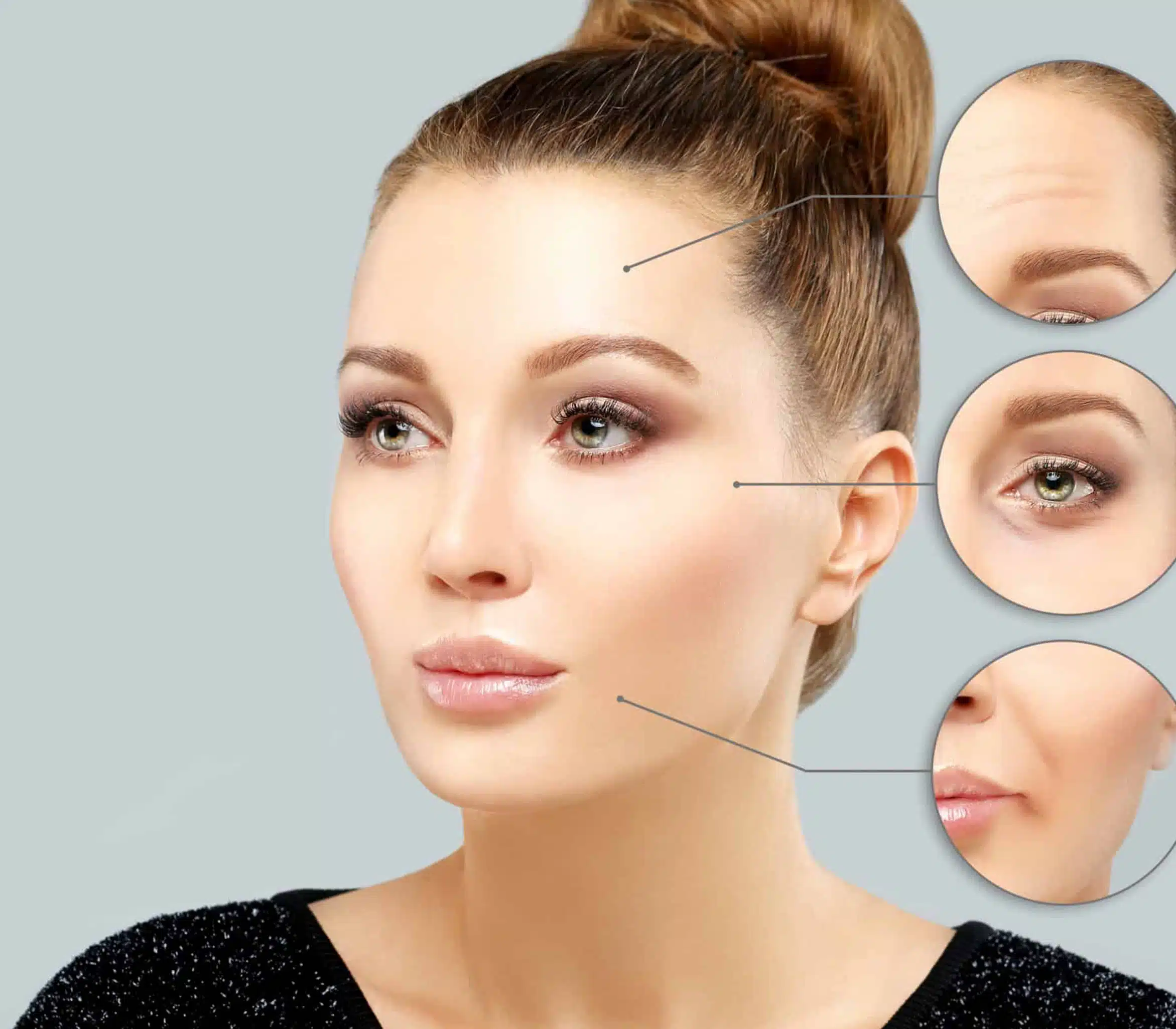Galderma fillers 