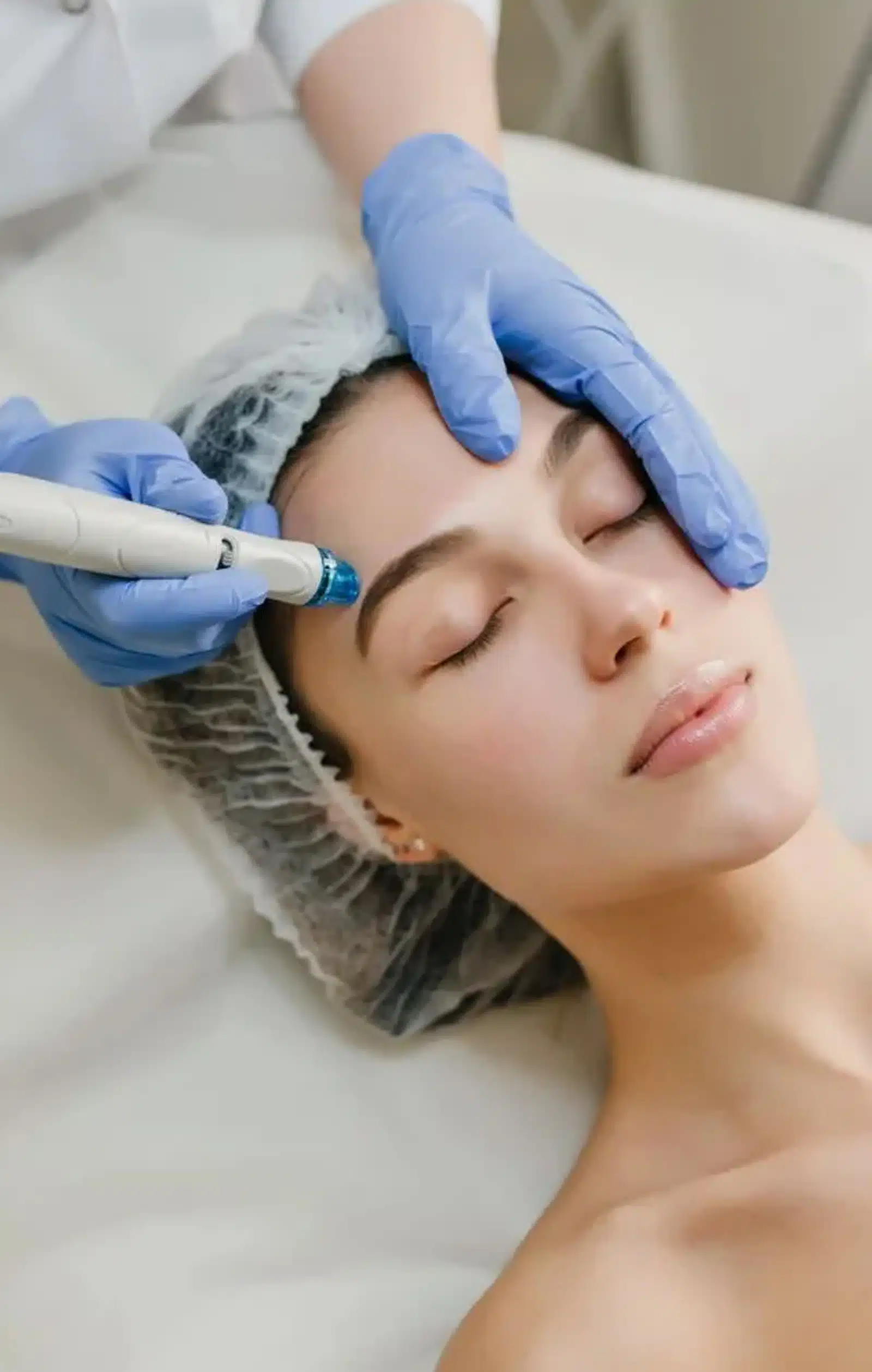Benefits of PRP Microneedling