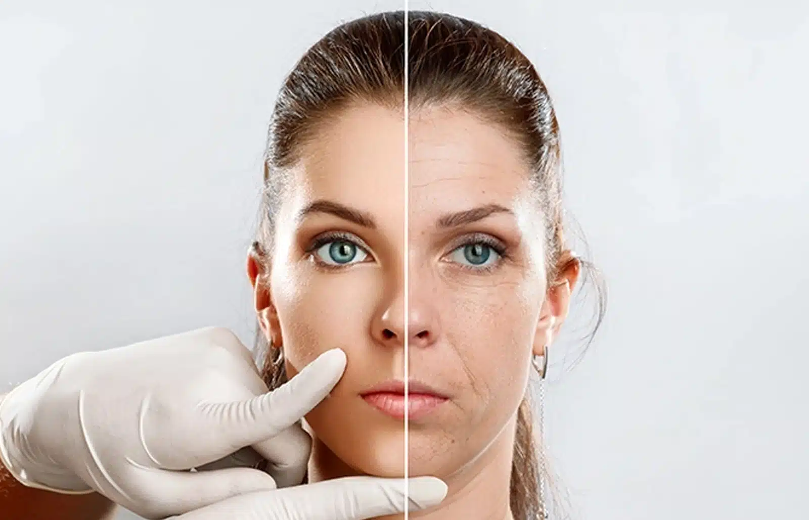 Botox Consultation Today