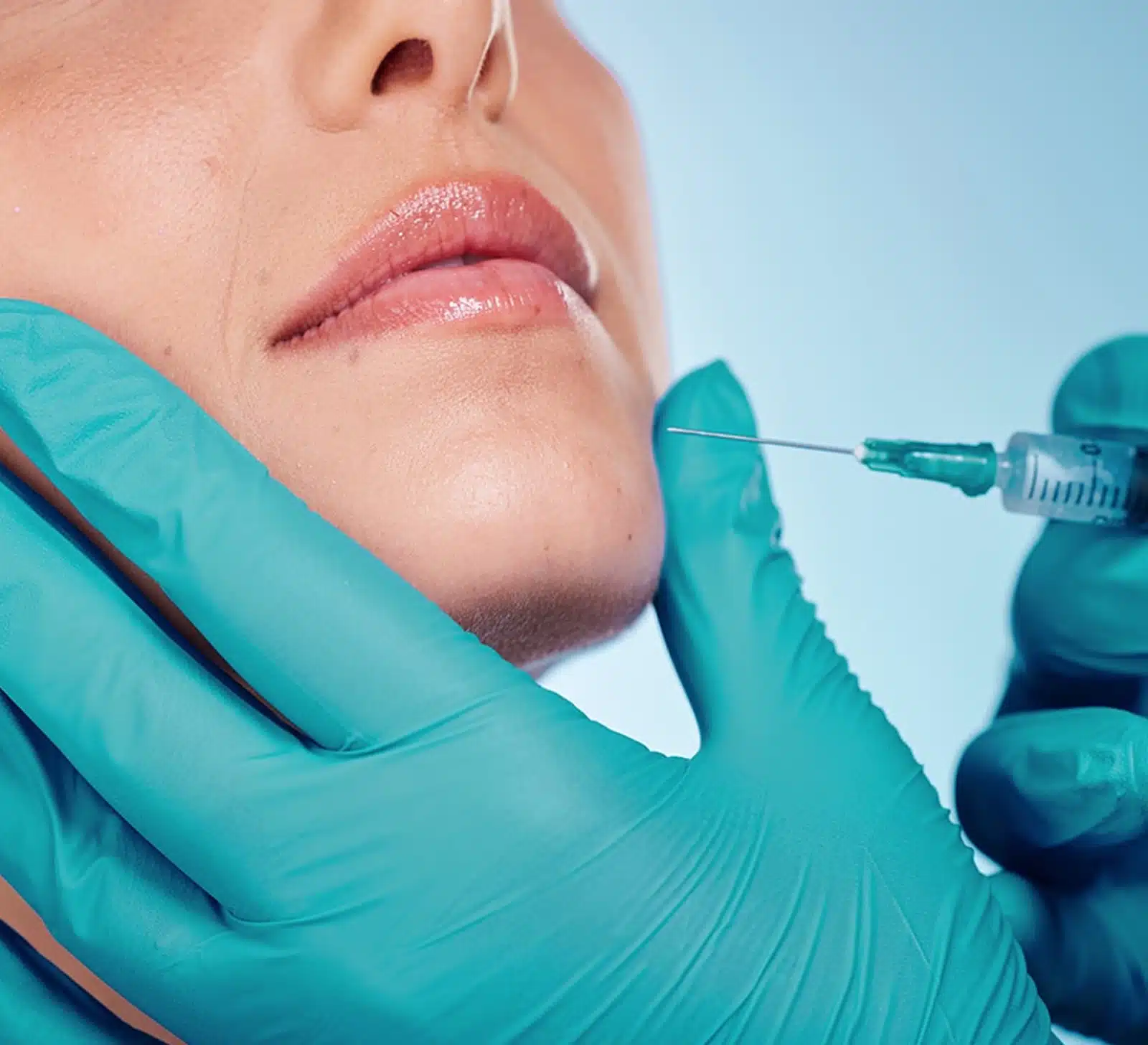 Botox with Dermal Fillers for Enhanced Results
