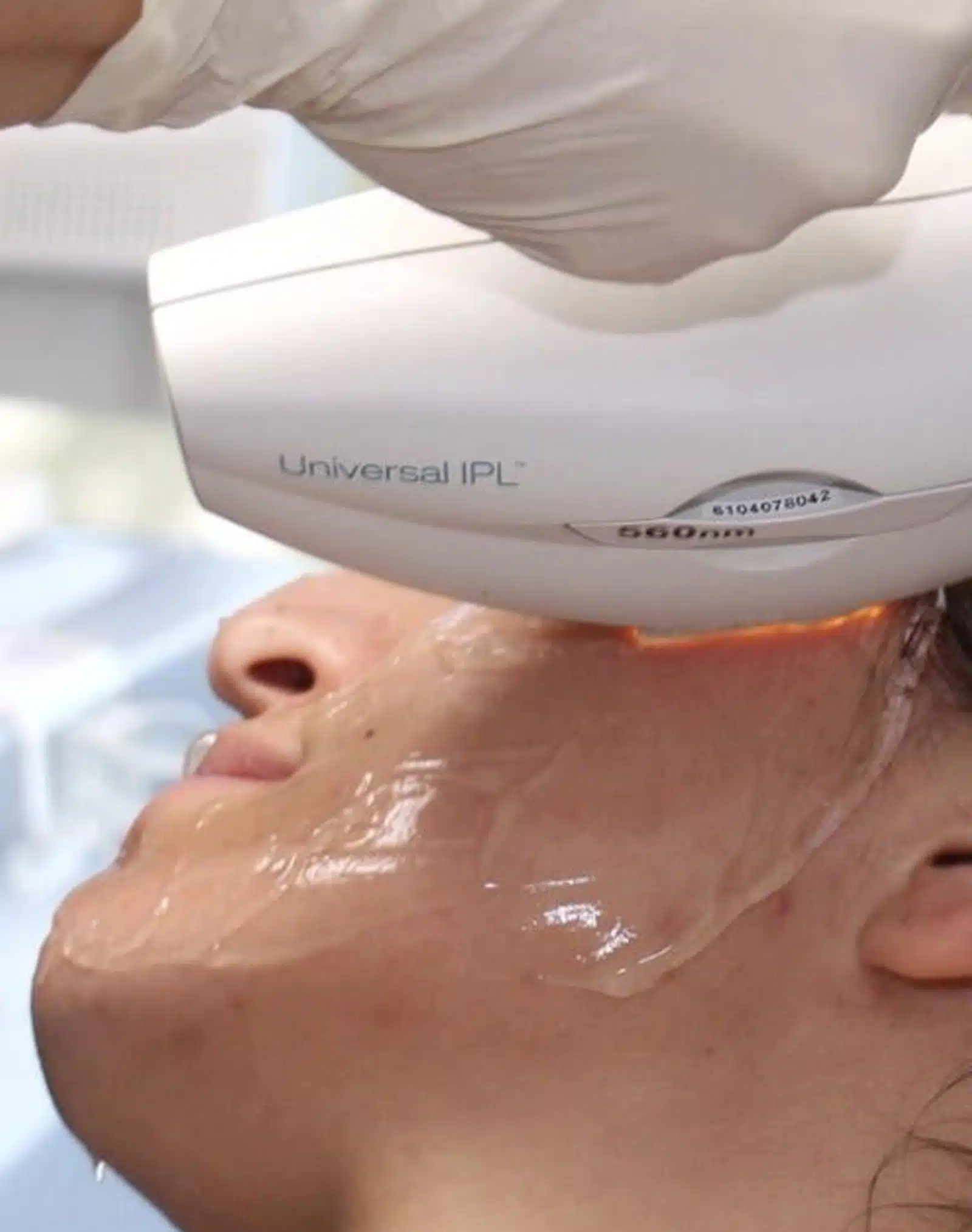 Eliminates Age Spots and Sun