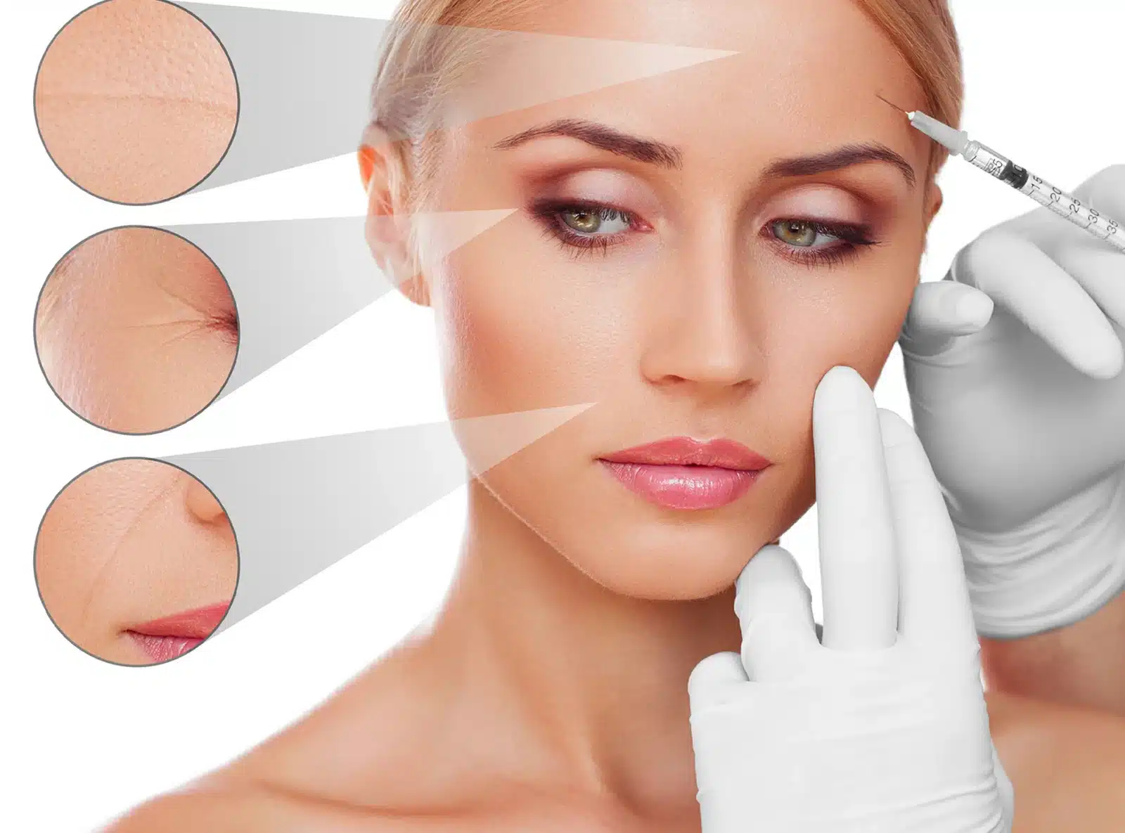 Expect After Botox Treatment