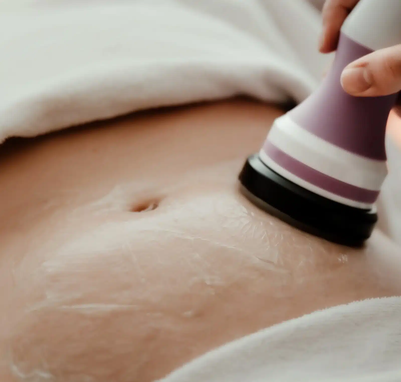 Treatment Experience at Wymore Laser