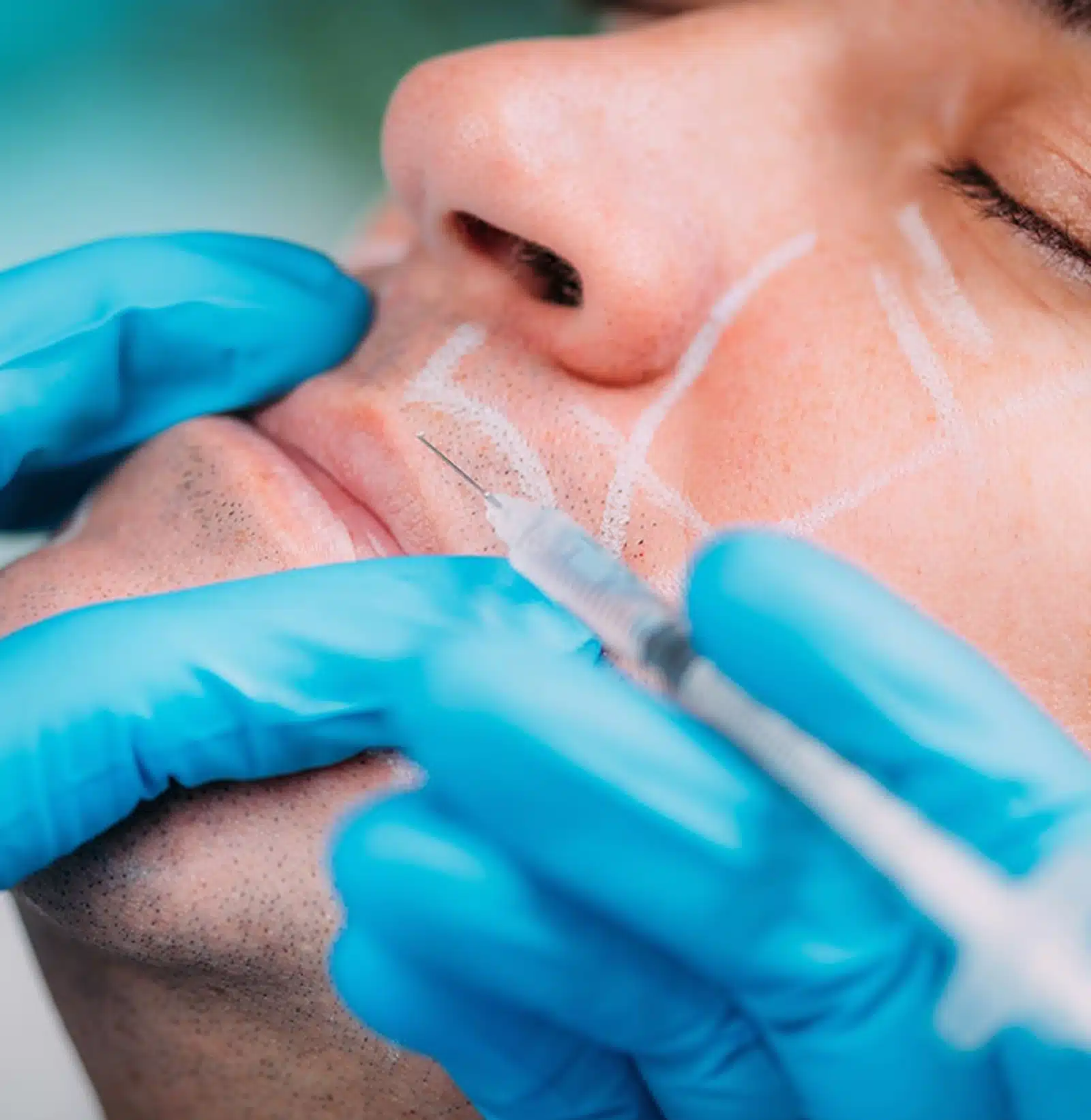 Wymore Laser & Anti-Aging Medicine