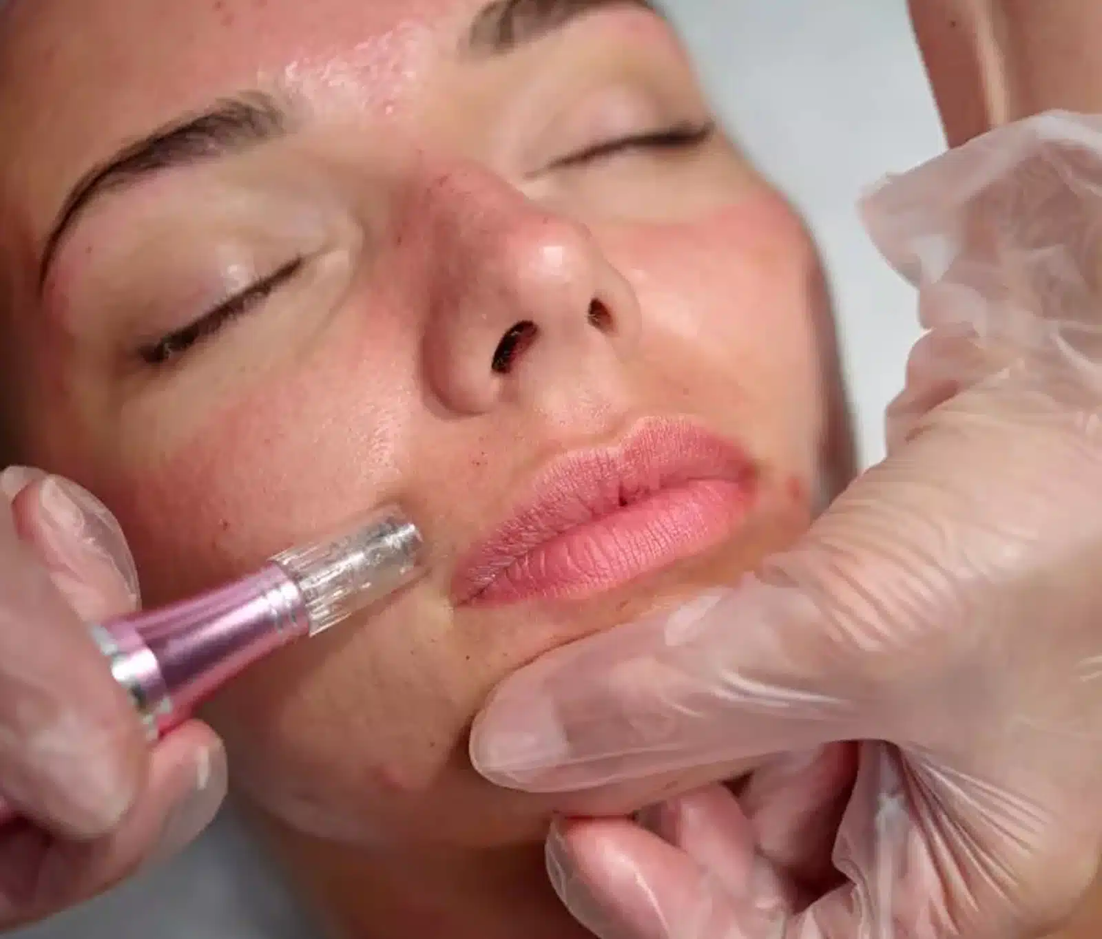 best results, complete 3 to 4 sessions