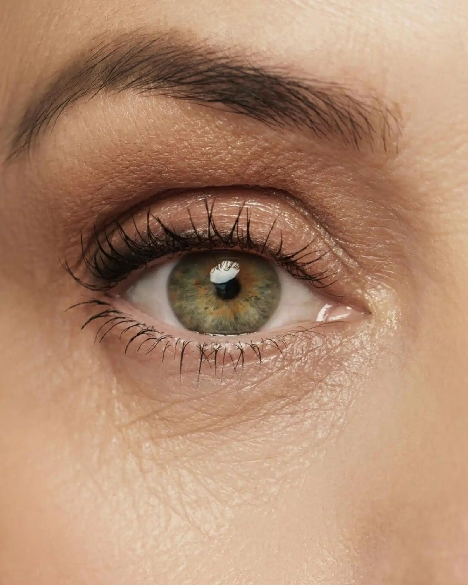 Causes Under-Eye Wrinkles