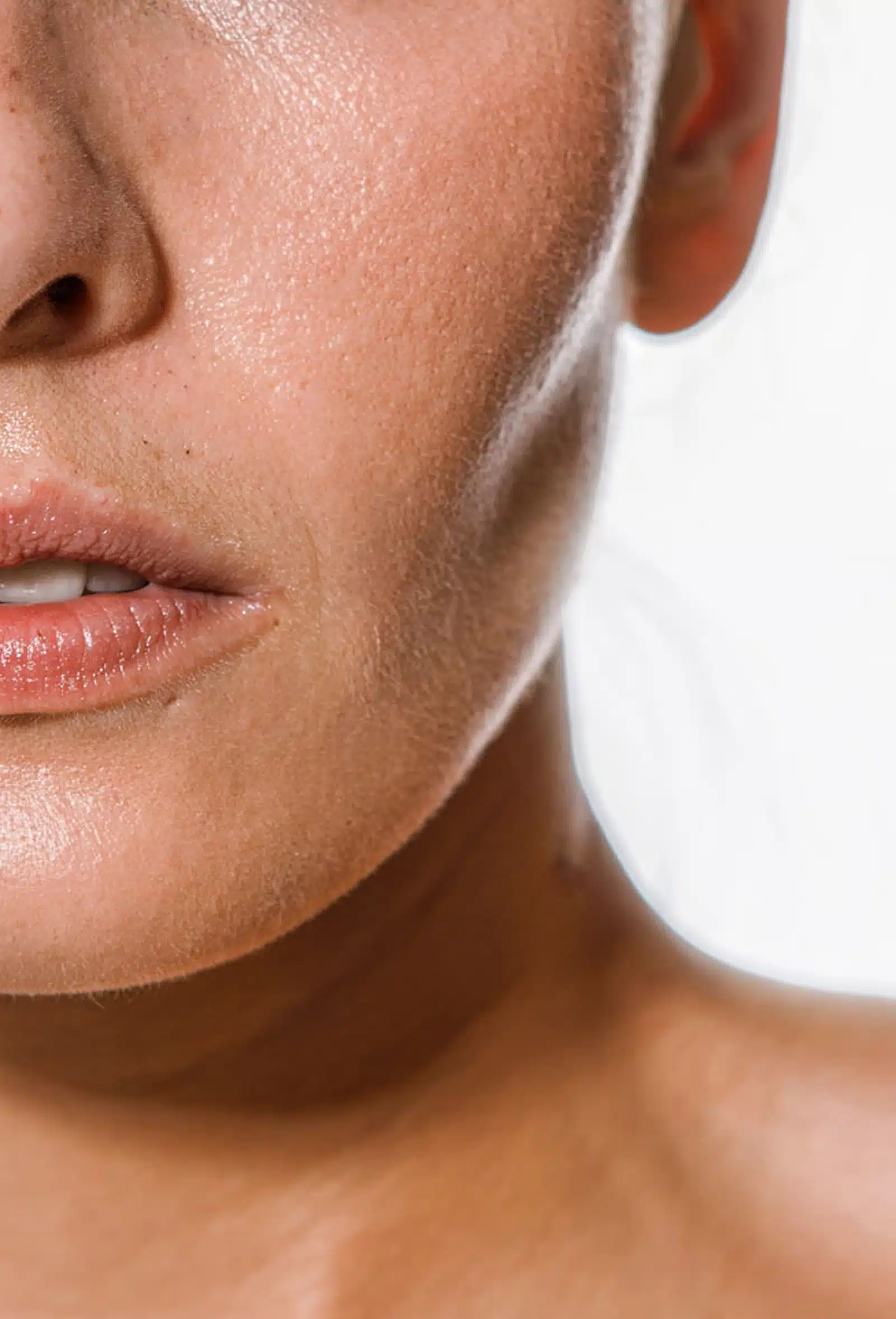 Prescription Topicals