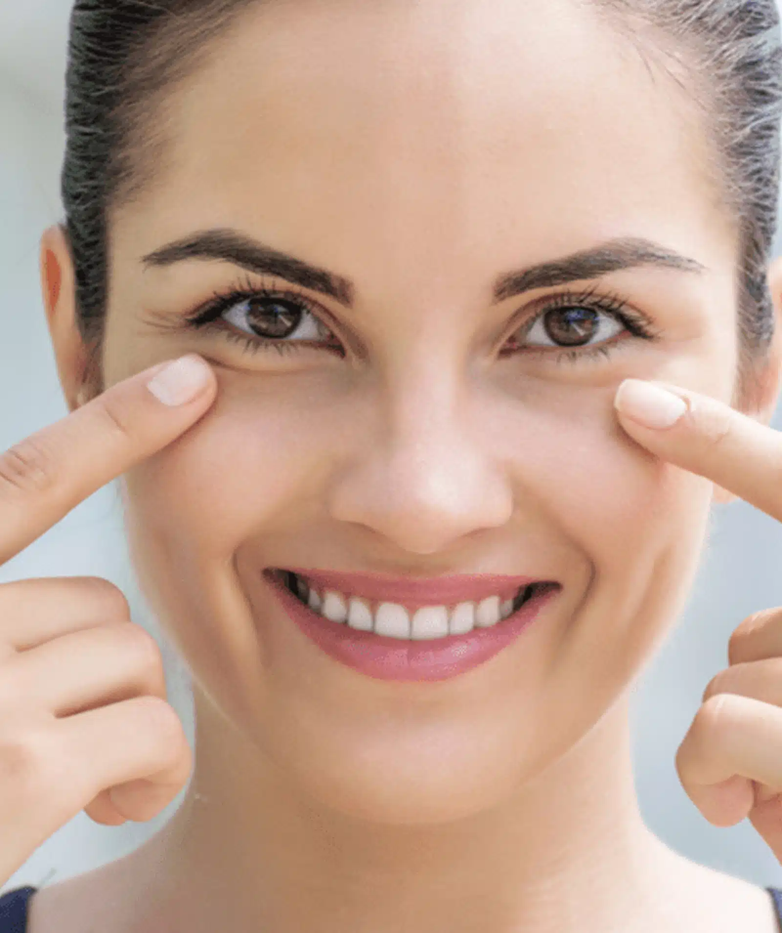 Primary Causes of Under-Eye Wrinkles