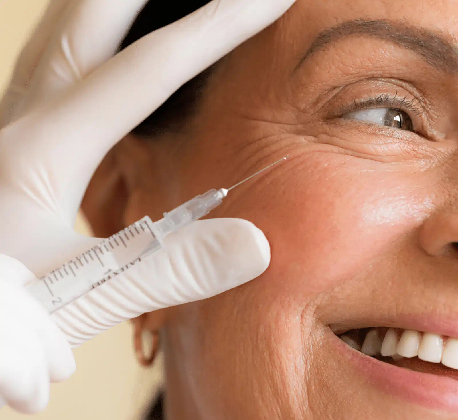 Dysport Aftercare Guide