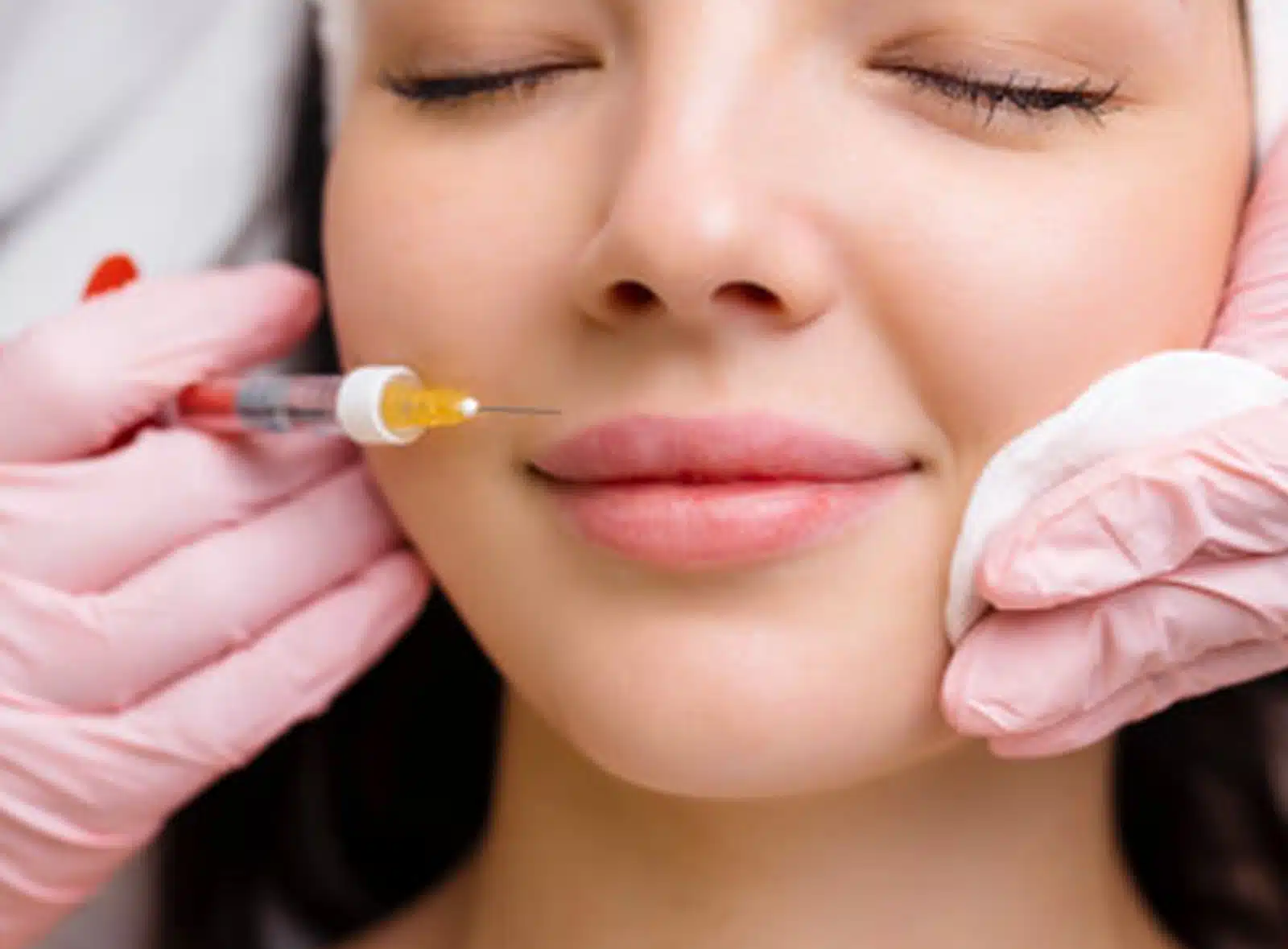 Lip Augmentation in Orlando