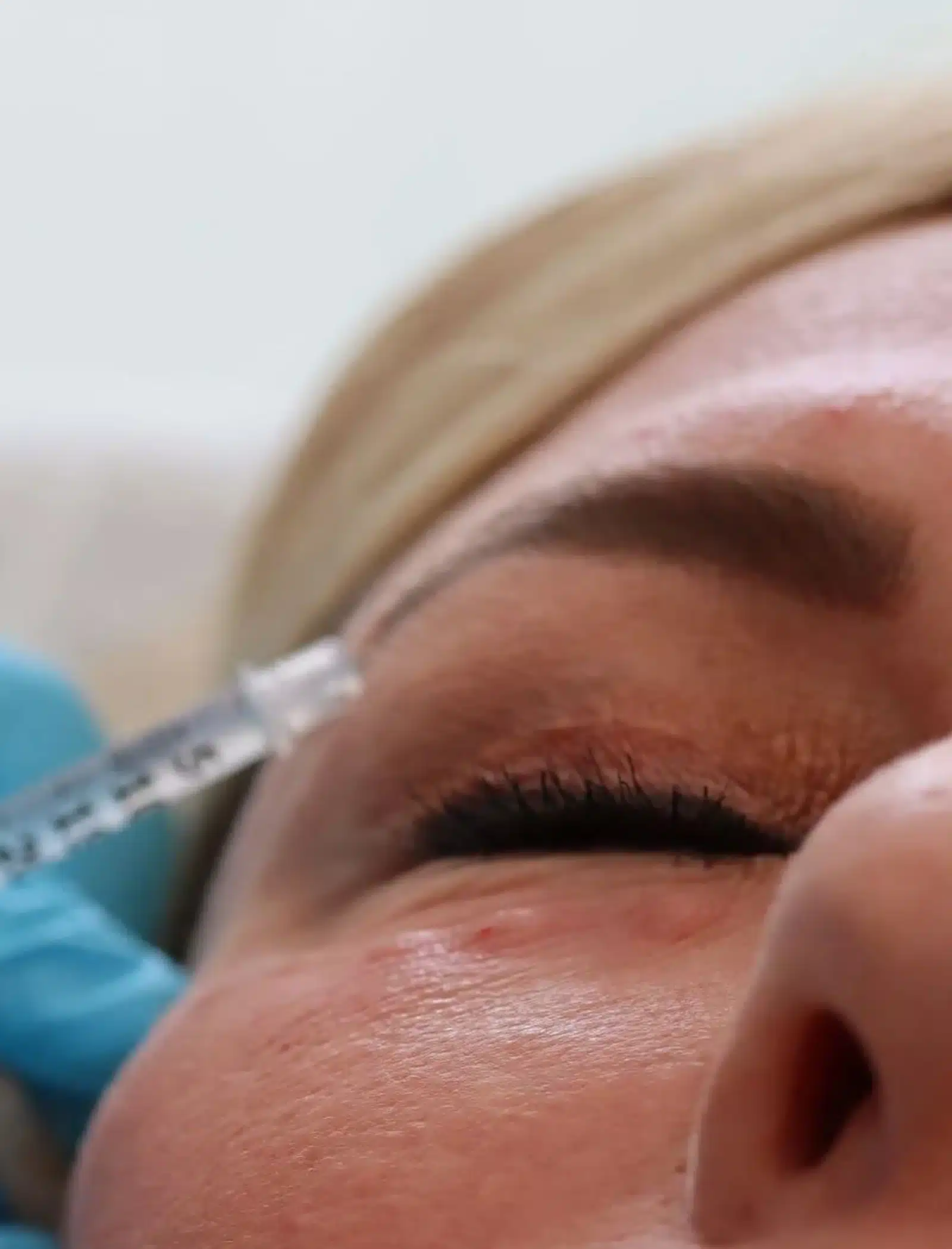 Prevents Future Wrinkles