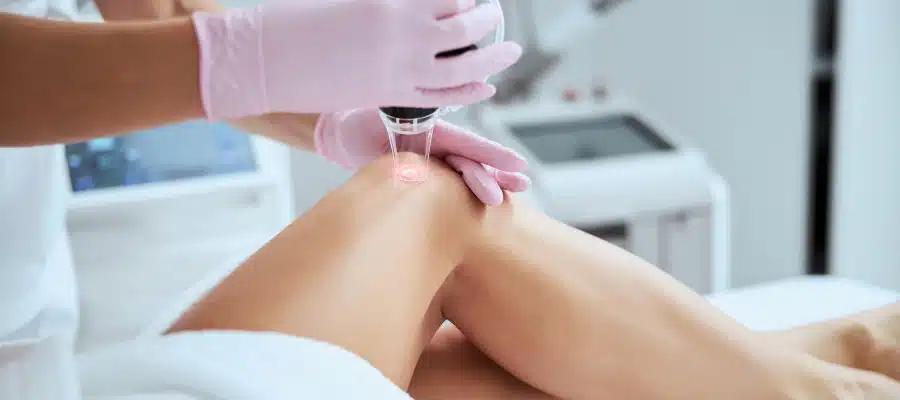 Professional Vein Treatment Near Me Orlando | Wymore Laser & Med Spa