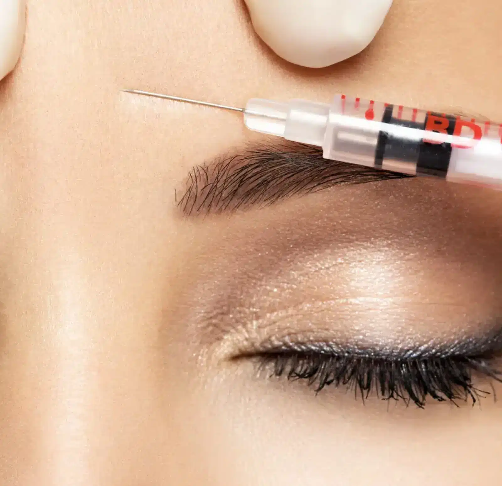 Understanding Forehead Lines