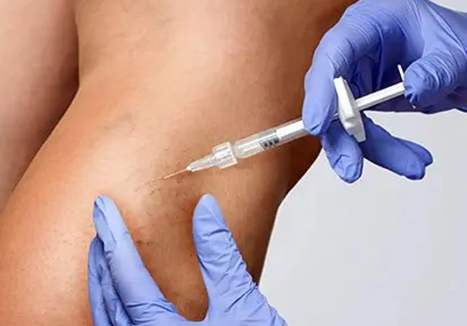 recovery is typically smooth